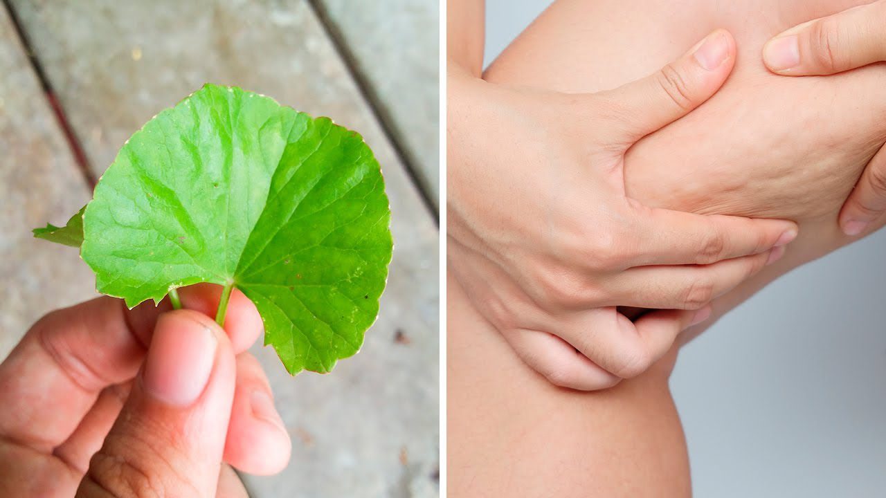 Ayurvedic Remedies for Varicose Veins: 4 Natural Ways to Heal Varicose Veins